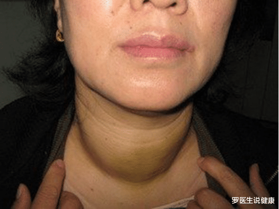 芋头|甲状腺“保护伞”被揪出，芋头未上榜，榜首天天吃，结节慢慢消散