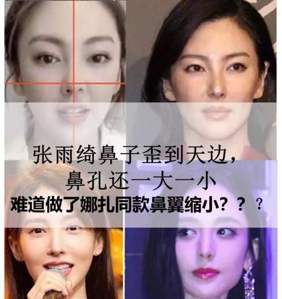 王一博|王一博鼻子透光引热议，医生曾指其缩鼻翼，多位明星因此被疑整容