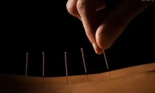 针灸 中医是站在高维宇宙看人体