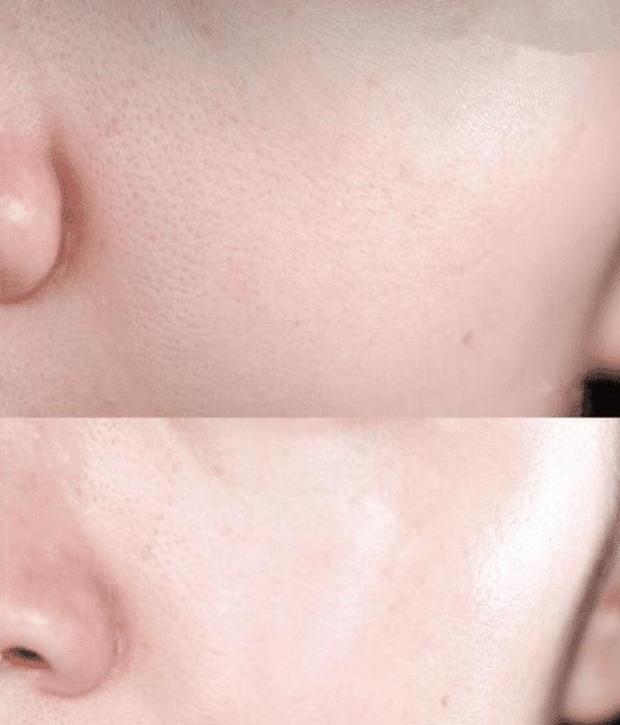 好物官|国外一女生连打6年美白针，如今已经烂脸，其实美白不用这么麻烦