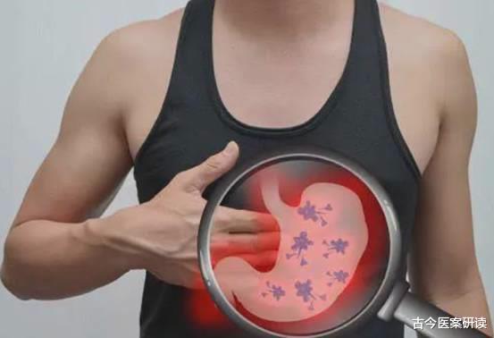 肠胃|吃玉米对胃不好?医生:愚昧!不想胃“烂掉”,3种食物要少吃