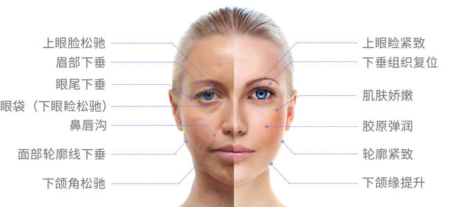 抗衰老|想要快速提升颜值？快收下依雪这份抗衰老秘籍