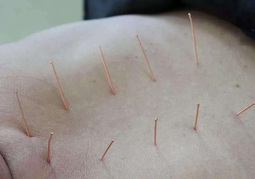 峰哥说表|暴雨天气风湿患者关节疼痛