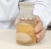 木耳|超微创取痛风石-足足70g的痛风石被取出来