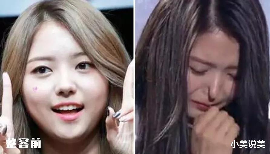 小美说美 究竟怎样才能整出自然、精致的鼻子呢?