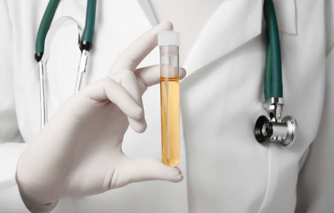 尼古丁|尿蛋白3+与24h尿蛋白定量3克哪个严重？