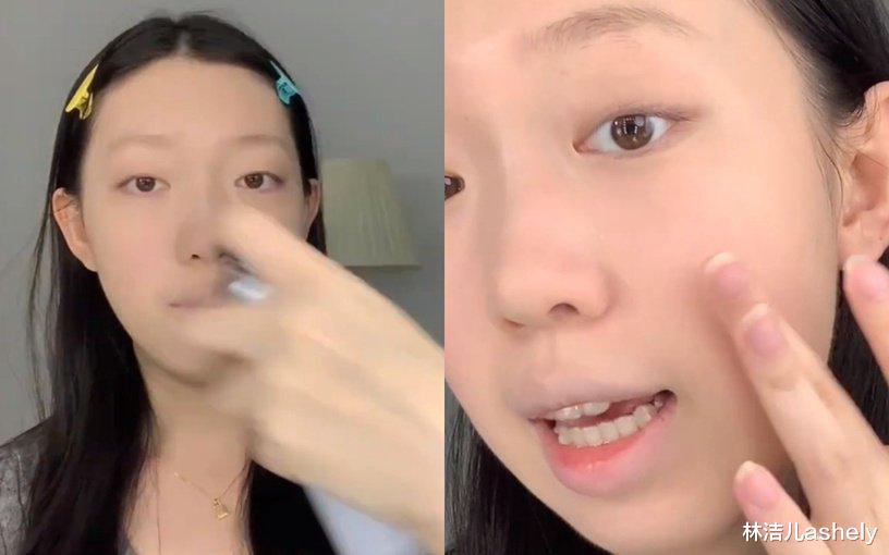 林洁儿ashely 没想到浪漫的背后都是额头换来的，秦海璐录节目晒到额头都脱皮了