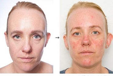 护肤品|孕期锁死这6款护肤品，好皮肤拿捏的妥妥的！怀孕了也回头率满满