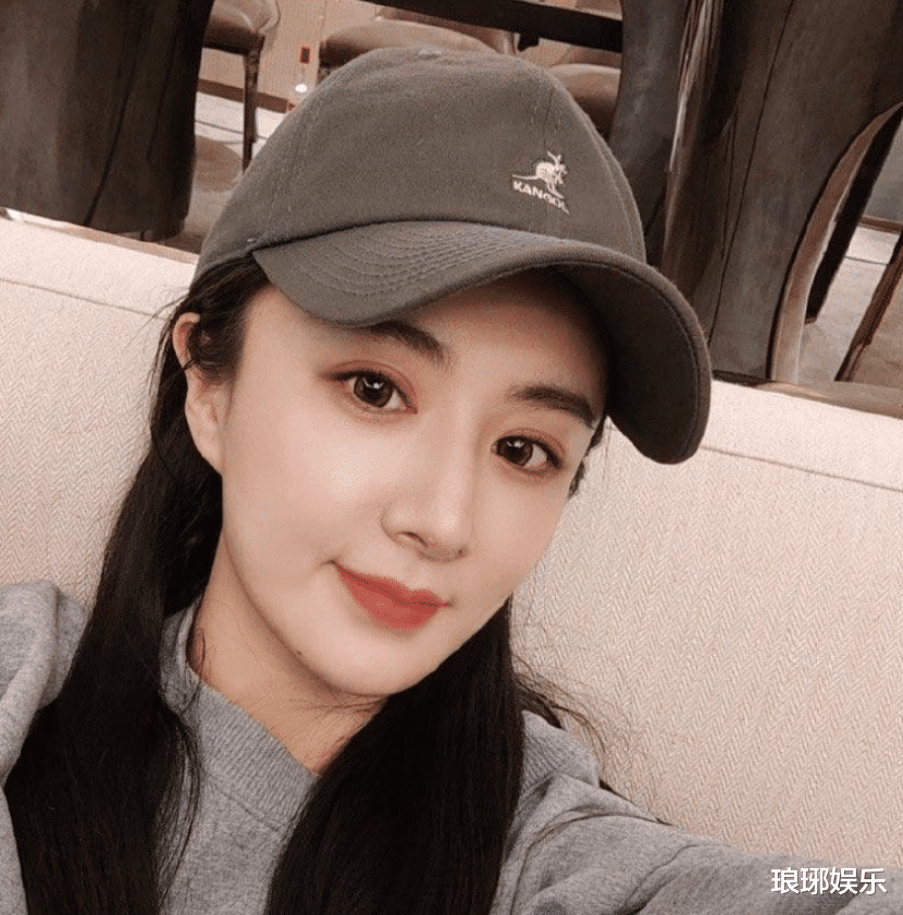 薇娅|薇娅做手术晒自拍，35岁素颜状态引关注，脸蛋是否纯天然很显然