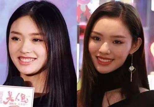 刘涛|这些明星做了烤瓷牙后，颜值反而下降了，连刘涛自己都后悔了！