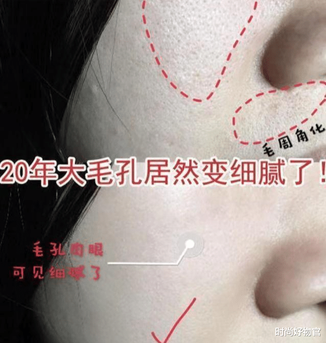护肤|74岁奶奶与孙子合照意外走红，“冻龄”状态惹人羡，护肤或是关键