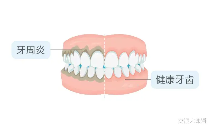 卖报大郎君 亲吻可能传播的4种疾病，很多人还不知道！