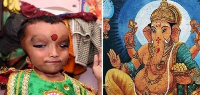 因長相神似象頭神，印度男孩被視為神明化身，連親爹都下跪供奉-圖4