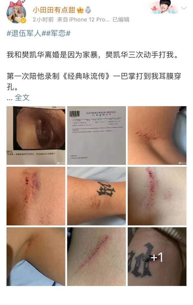 MARRY|隔壁老樊的“瓜”，疑似前嫂子爆料，这个节目翻车事故有点多