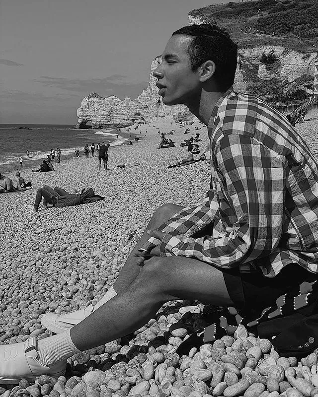 InsDaily 他被嘲“整形怪”10年！如今自曝毁容烧伤照，网友：又来炒作！