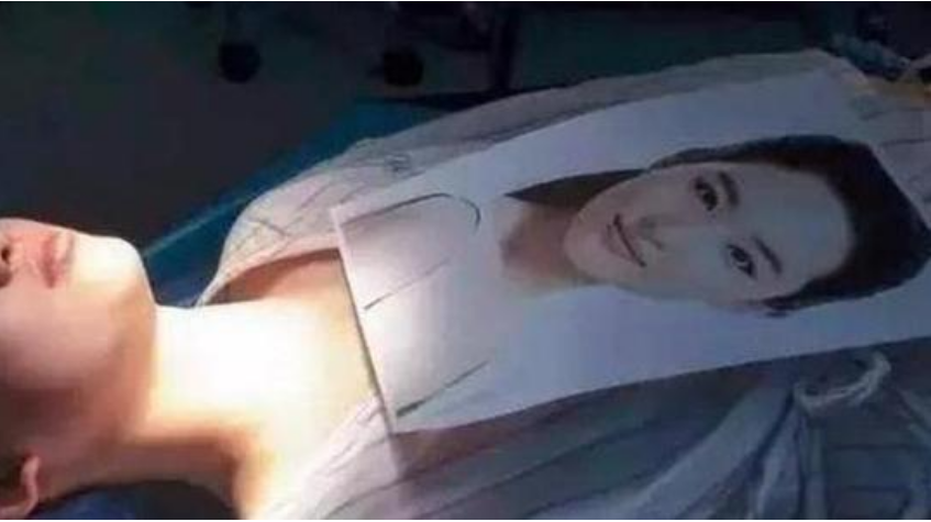 刘亦菲|19岁花百万整成刘亦菲，为追星名字改高仿，如今23岁判若两人