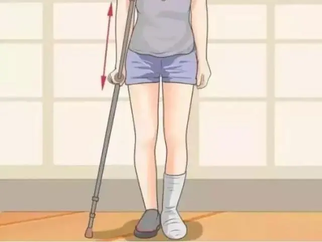 我叫小王|股骨头坏死锻炼少不了