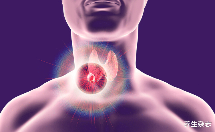 甲状腺|甲状腺的“知音”已找到,并非西红柿,医生:你若爱吃,结节无处藏身