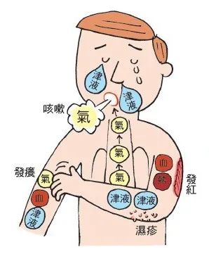 南瓜|九种体质之“阴虚”| 皮肤干燥、失眠、经常口腔溃疡是什么原因？如何调养？