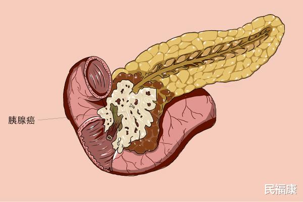 甜味剂|如果你经常喝酒,可以测试下酒瘾,来对照下自测表