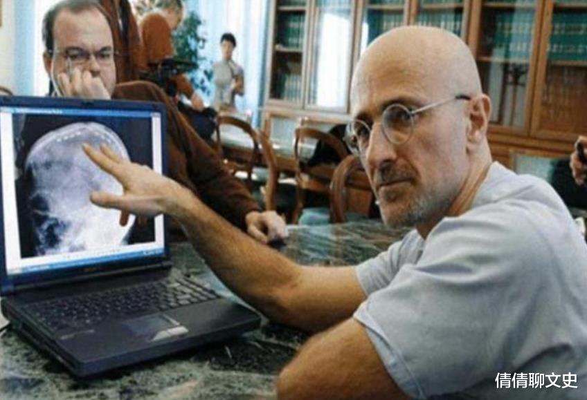 倩倩聊文史 哈医大任晓平：耗资7000万，完成世界首例“换头”手术，结局如何