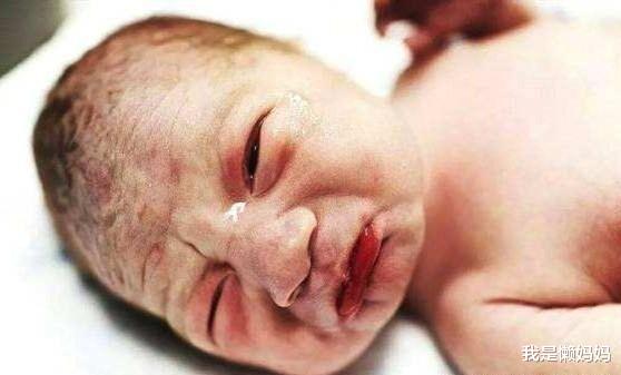 我是懒妈妈|新生儿6种看似奇怪其实正常的现象,顺其自然就好,无需过度关心
