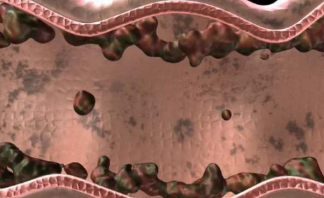 江湖微谈 每天大便三次，三天大便一次，哪种情况更加“危险”？