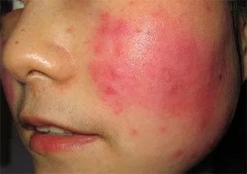 护肤品|垃圾国货护肤品排行榜！百雀羚、完美日记上榜，小众孕妇款却真香