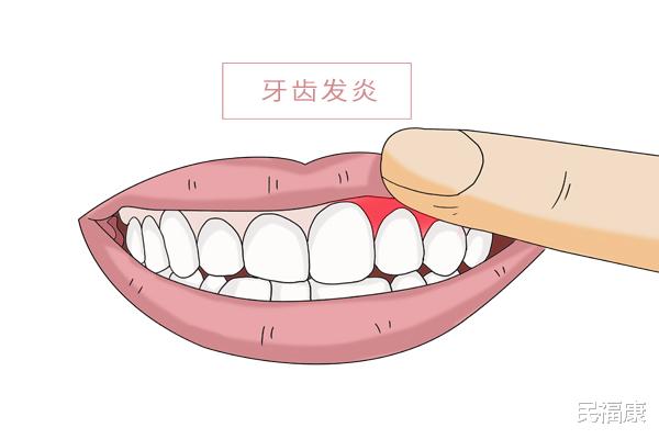 民福康|牙龈萎缩是怎么回事？洗牙会不会造成牙隐裂？