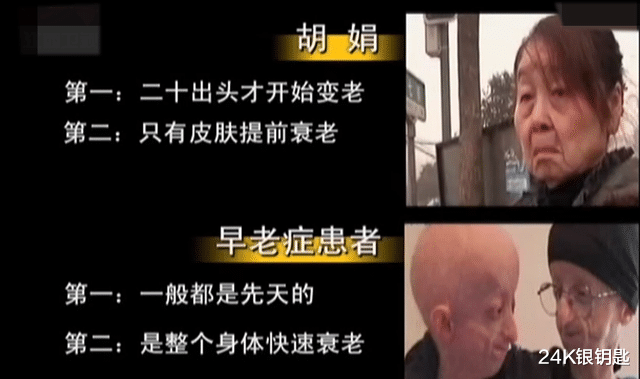 猫头鹰 80后妙龄少女,生完孩子一夜变老,背后到底发生了什么?