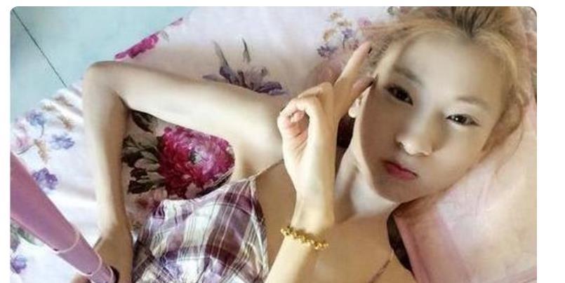 短发|“骷髅妹”：因爱“自虐”减肥，从120斤减到57斤，瘦成了皮包骨