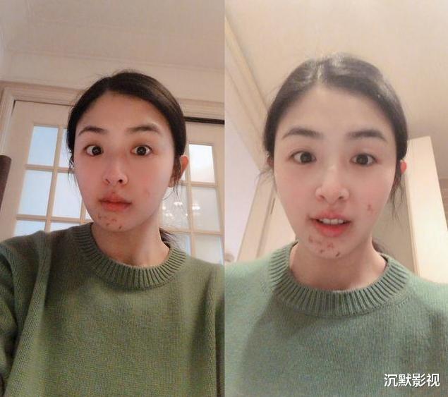 运动|张含韵坚持大半年，“胖妞”逆袭变美女，这一项运动有很大功劳！