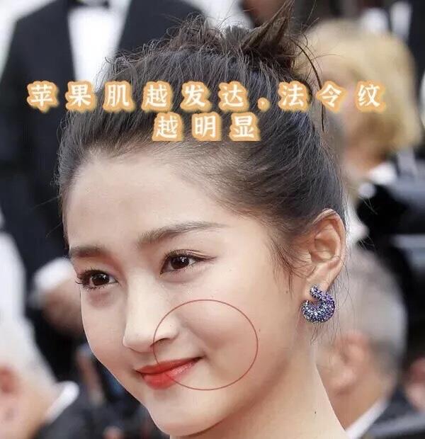 杨紫|法令纹也太可怕了！杨紫年纪轻轻怎么老成这样了！