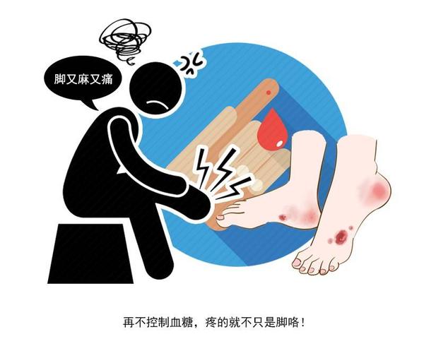 睡眠|睡觉时3个症状你全占，很遗憾，你可能是糖尿病候选人！自查一下