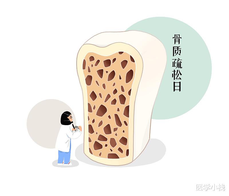 医学小栈|养骨“明星”找到了，不是豆腐，少吃2种食物，骨头或越来越健康