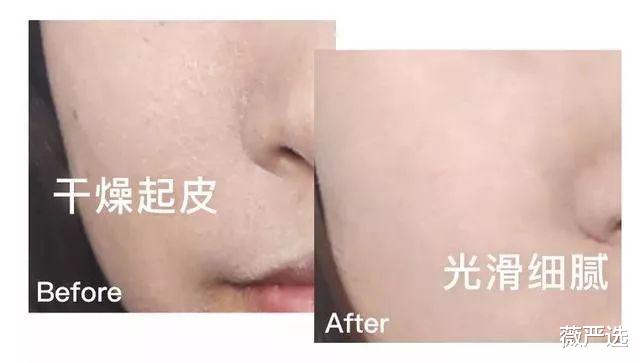 |女子连打6年美白针，现在皮肤有什么变化了？网友：难以置信