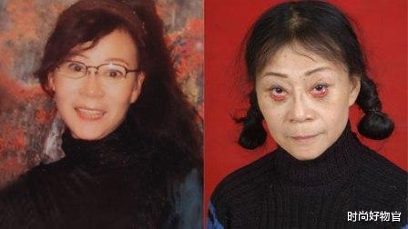 时尚好物官|继眼皮“除皱术”后，我国又一“抗衰老”方式走红，既安全又方便