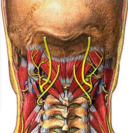智象针灸埋线|病根埋线治疗枕大神经痛