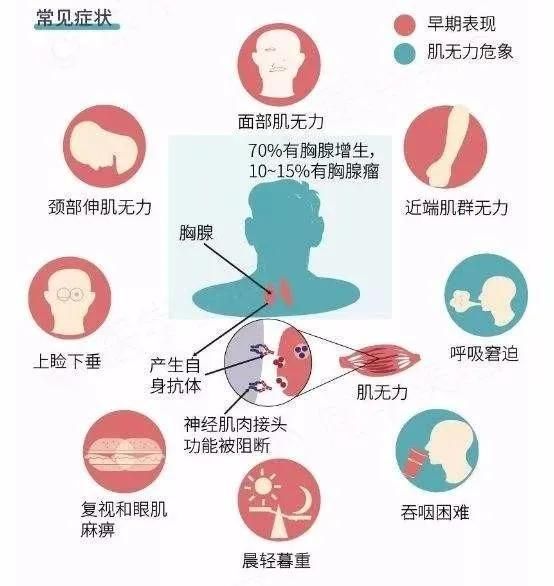 中科西部干细胞研究院:干细胞的免疫调节能力拯救“重症肌无力”人群