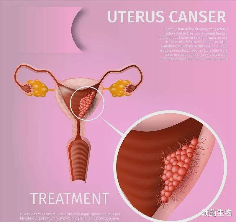 卵巢 国际妇产杂志：干细胞及其外泌体治疗早发性卵巢功能不全临床探究