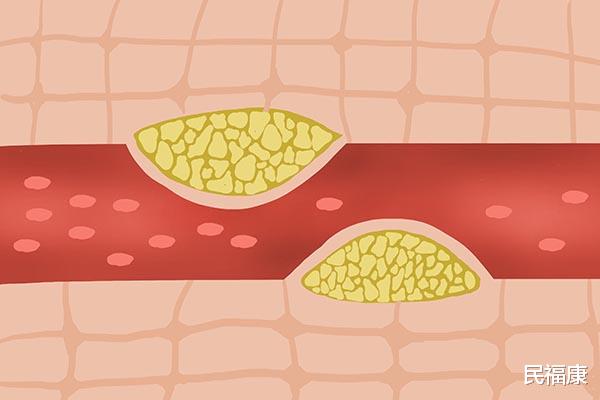 养生|老年人注意：这些养生习惯，长期坚持并非有利健康，反而会伤身