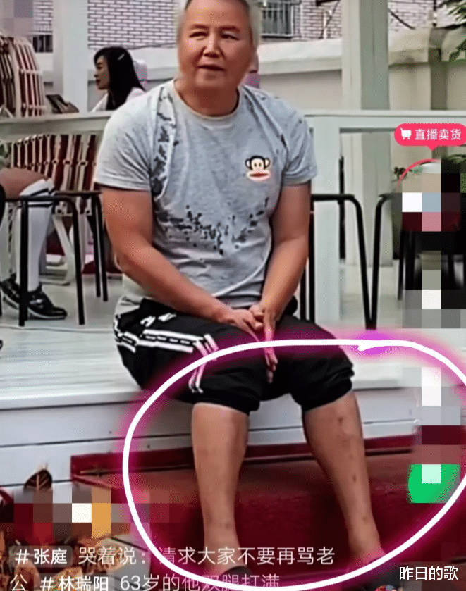 林瑞阳|怎么回事？张庭突然恳求网友不要骂林瑞阳，说他特别不容易