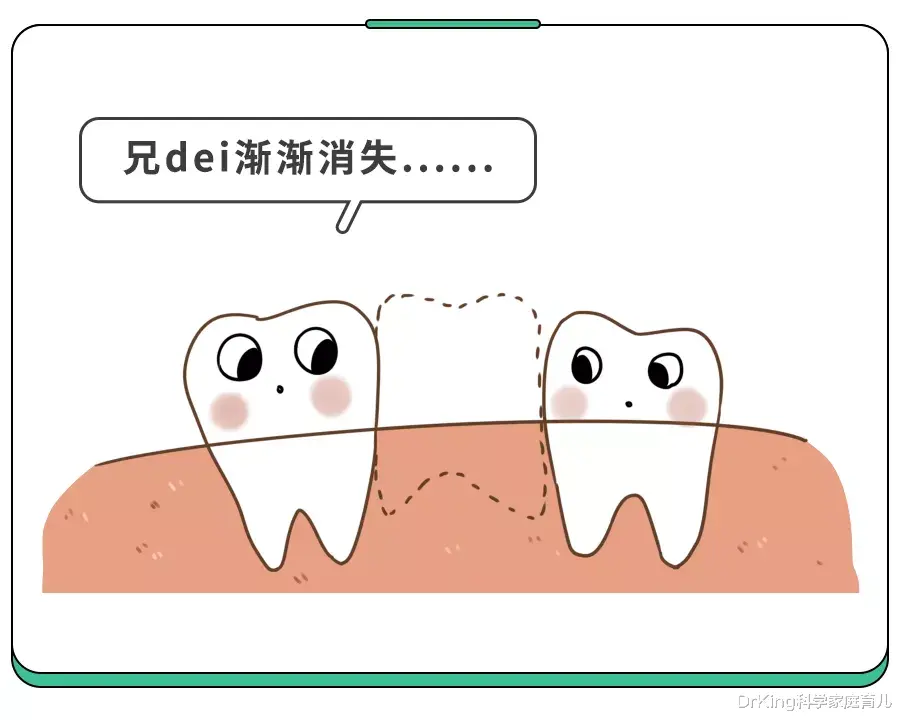 DrKing科学家庭育儿|5岁儿童蛀牙率70%！别只“控糖”了，这件事更要紧！