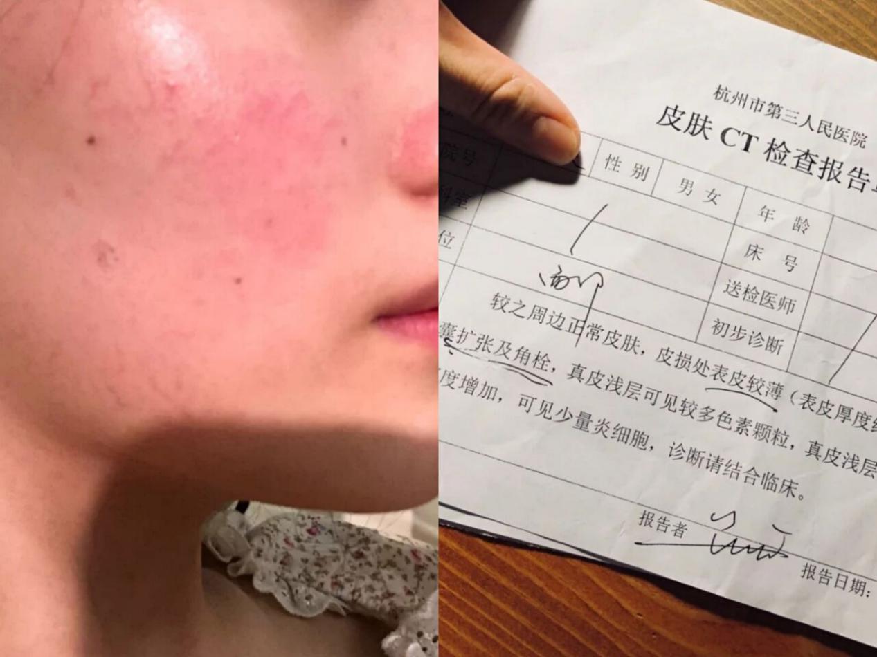 面膜 靠生娃变美？孕期长胎不长肉，变身成辣妈全攻略，新手妈妈必看！