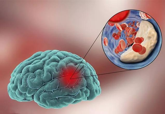 睡眠|血液的“稀释剂”已找到，不是白开水，你若爱吃，血管一通到底