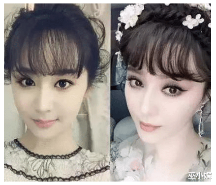 杨紫|杨紫脸又崩了？疑似玻尿酸打太多，下巴尖到离谱！