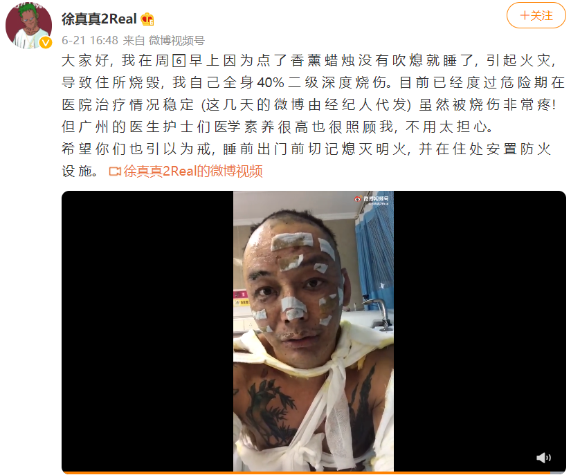 徐真真|giao哥在夜店被打后，徐真真全身深度烧伤，说唱歌手多灾多难