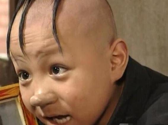 吴孟达|他凭“三毛”一夜爆红，因谢顶缝合300针，今容貌大变无人识