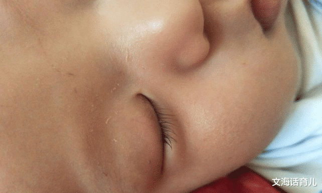 脾胃|小孩面部有3种迹象，或许脾胃已“烂如蜂窝”，占一个，也要好好养脾