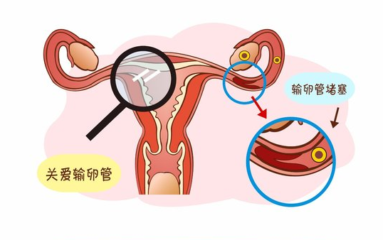 洪芙蓉医师|三胎政策来啦！却连资格都没有，你需要这份攻略！